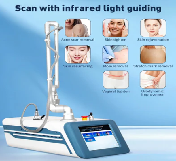 CO2 Laser Cost & ROI: 5-Yr Analysis for MedSpa Scar Repair
