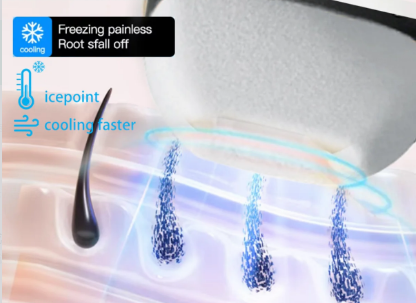 Sapphire Cooling in Diode Laser Hair Removal Machines: How It Works and Why It Matters