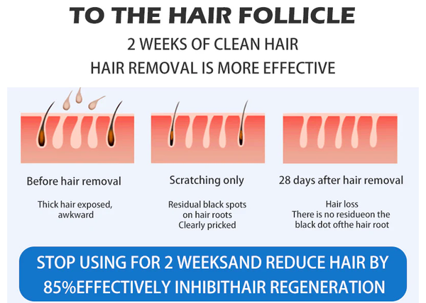 How Many Sessions For Full Permanent Hair Reduction？