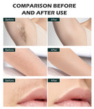 Salon and Home Laser Hair Removal Devices, Mini Portable Hair Removal Tools, Perfect for Daily Beauty Care