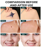 4-in-1 Multi-functional Laser Picosecond Beauty Device, Integrating Hair Removal, Whitening and Skin Rejuvenation Functions