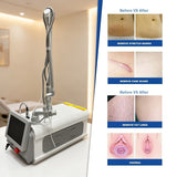 CO2 Fractional Laser Machine | Wrinkle, Scar & Pigment Rem