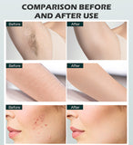 4-in-1 Multi-functional Laser Picosecond Beauty Device, Integrating Hair Removal, Whitening and Skin Rejuvenation Functions