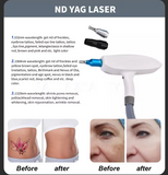 OPT 2-in-1 Pico Laser Beauty Device, Facial & Body Device Hair Removal + Acne Redness Reduction