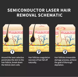 OPT 2-in-1 Pico Laser Beauty Device, Facial & Body Device Hair Removal + Acne Redness Reduction