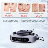 I7 Professional Home Nano-microcrystalline Beauty Instrument, Facial Beauty to Remove Blemishes