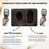 Multifunctional hair removal device, using FAC technology for full-body hair removal, for more pronounced results, whitening, rejuvenating, and pore-tightening.