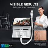 Pro Diode Laser | Large Screen, Painless, Permanent Hair Rem