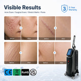 Advanced CO2 Fractional Laser Machine – Precision Cutting & Deep Resurfacing Platform