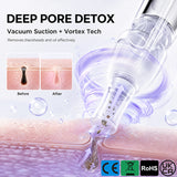 9 in 1 Hydra Dermabrasion Machine – Professional Facial Skin Management System