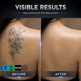 Pro 2-in-1 Laser Hair Removal: 12bar + FAC for Home & Salon