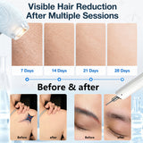 Newly Upgraded Diode Laser 2-in-1 System – 5 Wavelengths + Picosecond for Clinics & Salons
