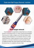 980nm vertical screen 4-in-1 professional nail fungus removal device, multi-functional beauty instrument
