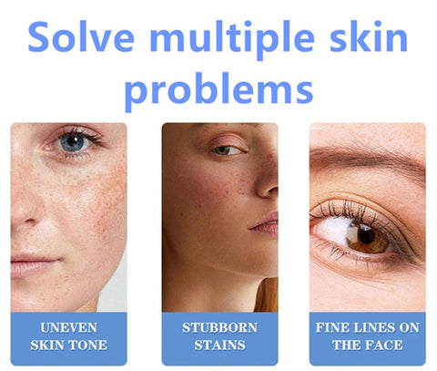 Picosecond Nd:YAG Laser Beauty Device: Multi-wavelength Pigmentation Removal, Tattoo Removal, Skin Tightening