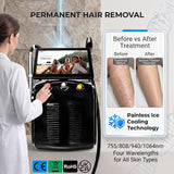 Soprano Titanium 2-in-1 | Hair Removal & Skin Rejuvenation