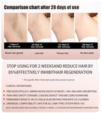 2026 Painless Laser Hair Removal Device, Suitable For Sensitive Skin, LCD Display For Easier Operation, Suitable For The Whole Body,Home Salon Hair Removal Essential