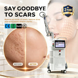 Vaginal Tightening CO2 Laser Machine – Ergonomic 5-in-1 Skin & Intimate Care System