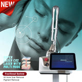 CO2 Fractional Laser Skin Resurfacing Machine - Face & Body Rejuvenation for Pigmentation Removal, Acne Scar Treatment, Wrinkle Reduction & Skin Tightening - Home and Salon Use Vaginal Rejuvenation Machine