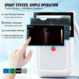 TM059-01 White Arctic Laser | LCD Handle for Hair Removal