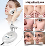 DEP 2 Generation Beauty Device All Skin Types Hydration & Anti-Aging