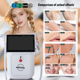 2-in-1 Diode & Pico Laser | Hair & Tattoo Removal + Skin Rejuvenation