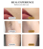 B61 2-in-1 Matte Black, Professional 2-in-1 Diode Laser & Picosecond Beauty Device – 4 Wavelengths, 5 Picosecond Heads for Permanent Painless Hair Removal & Tattoo Pigment Removal, All Skin Areas, Men & Women