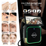 4-in-1 Diode Laser Beauty Device | Hair Removal & Skin Treatment