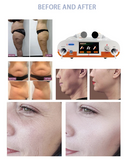 Professional Salon Beauty Equipment For Wrinkle Removal And Skin Firming