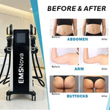 EMSnova Slimming | Fat Loss & Muscle Building + Peach Butt
