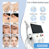 4-in-1 Multifunctional Beauty Tool for Hair Removal, Whitening, and Skin Rejuvenation. One Device for Both Hair Removal and Skincare, Making Skincare Easy