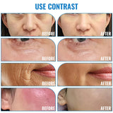 DEP1 Generation Portable Beauty Tool Skin Tightening and Pore Minimization, Home Beauty Essential