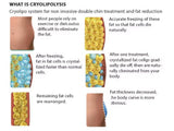 Desktop Cryolipolysis | CE-Certified Gentle Fat Freezing