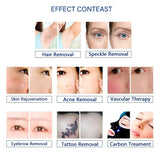 Dual-Handled Hair and Freckle Removal Beauty Device, Anti-Aging and Skin Rejuvenation Machine, with A Foldable Display for Convenient Storage