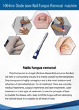 980nm vertical screen, professional onychomycosis removal, portable beauty device