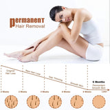 Diode Laser Hair Removal Device, Ice-handle Painless Permanent Hair Removal Equipment, Home Salon Hair Removal Device